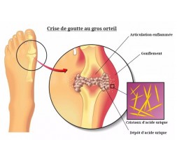 Le 27 mai 2023 - Les atteintes de la peau - Comment soulager le patient ? - Han-sur-Lesse