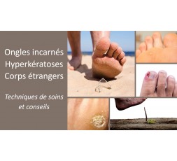 Le 23 mai 2024 - Ongles incarnés, hyperkératoses et corps étrangers - Techniques de soins et conseils - Pecq