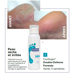 DD Crème Mousse - 300 ml - N°1